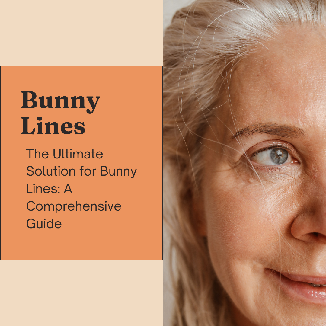 The Ultimate Solution for Bunny Lines: A Comprehensive Guide