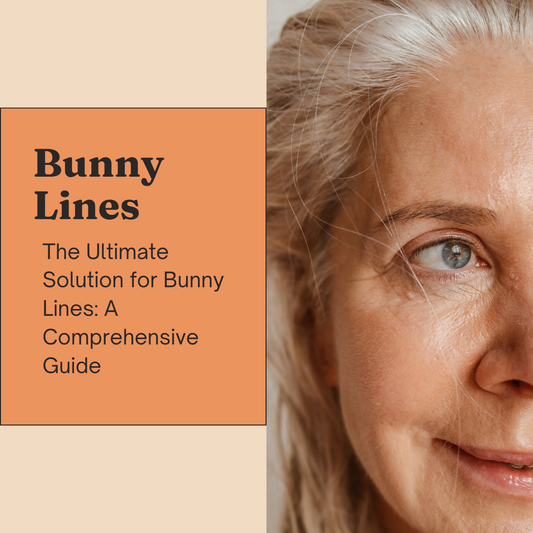 The Ultimate Solution for Bunny Lines: A Comprehensive Guide